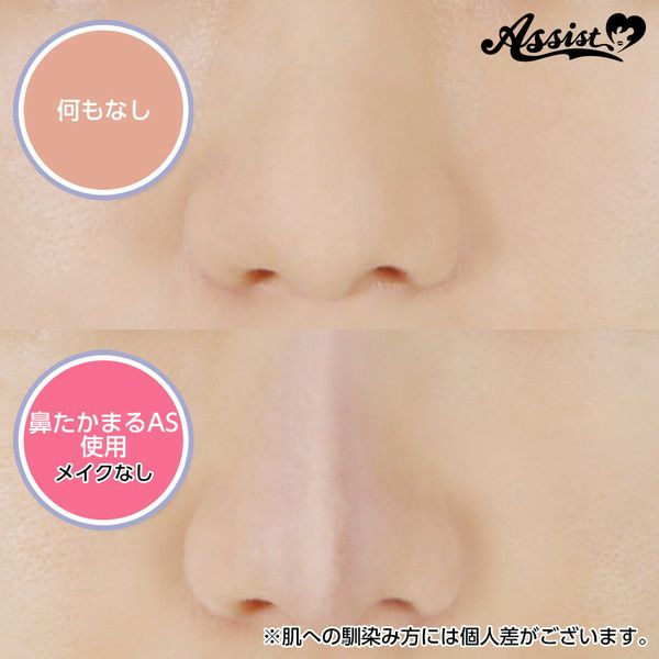 鼻たかまるAS(特殊メイク顔用パテ)鼻への使用例|コスプレカラコン通販アイトルテ